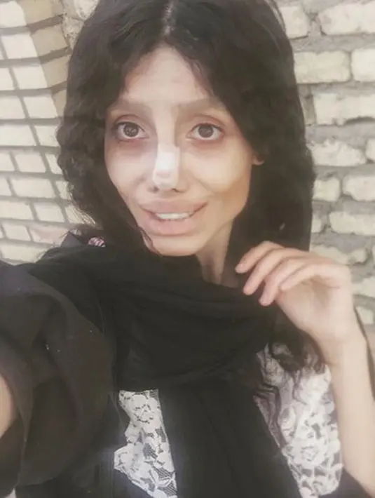 Bukan hanya operasi plastik, namun penggemar Angelina Jolie tersebut juga melakukan diet yang super ketat. Hingga sekarang ini tubuhnya sangat lah ramping, ia hanya memiliki bobot sebesar 40 kg.   (Instagram/sahartabar_official)