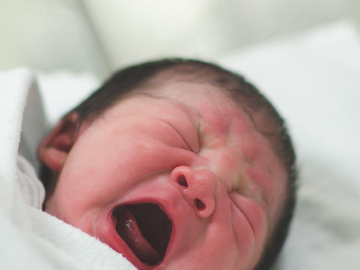 Penyebab Biang Keringat pada Bayi