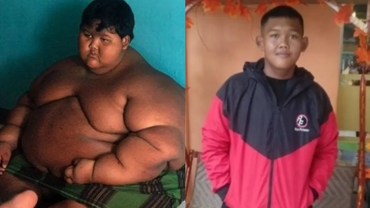 6 Potret Transformasi Arya Permana Bocah Berbobot Nyaris 200 Kg, Bikin Takjub