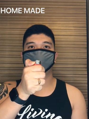 Curhat Pilu Wanita Terluka Di Wajah Gegara Masker Kain Berawal Dari Jerawat Berujung Operasi Surya Malang