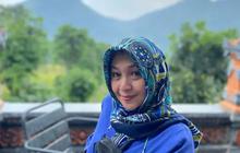 Sahabat Dina Mariana Ungkap Sebelum Meninggal Dunia, 3 Tahun Berjuang Melawan Penyakit Endometriosis