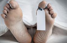 Warga Boyolali Meninggal karena Leptospirosis, Begini Penjelasan Kemenkes