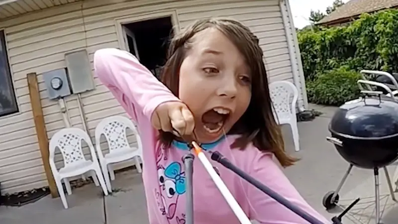 Aksi Unik Bocah yang Gunakan Slingbow untuk Mencabut Giginya
