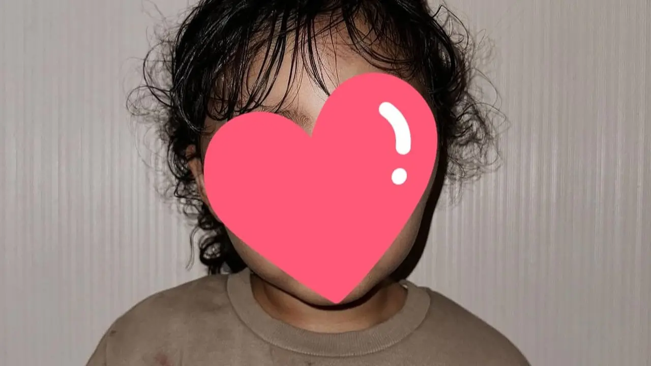 Anak Selebgram Dianiaya oleh Baby Sitter Sampai Luka Lebam di Mata dan Telinga