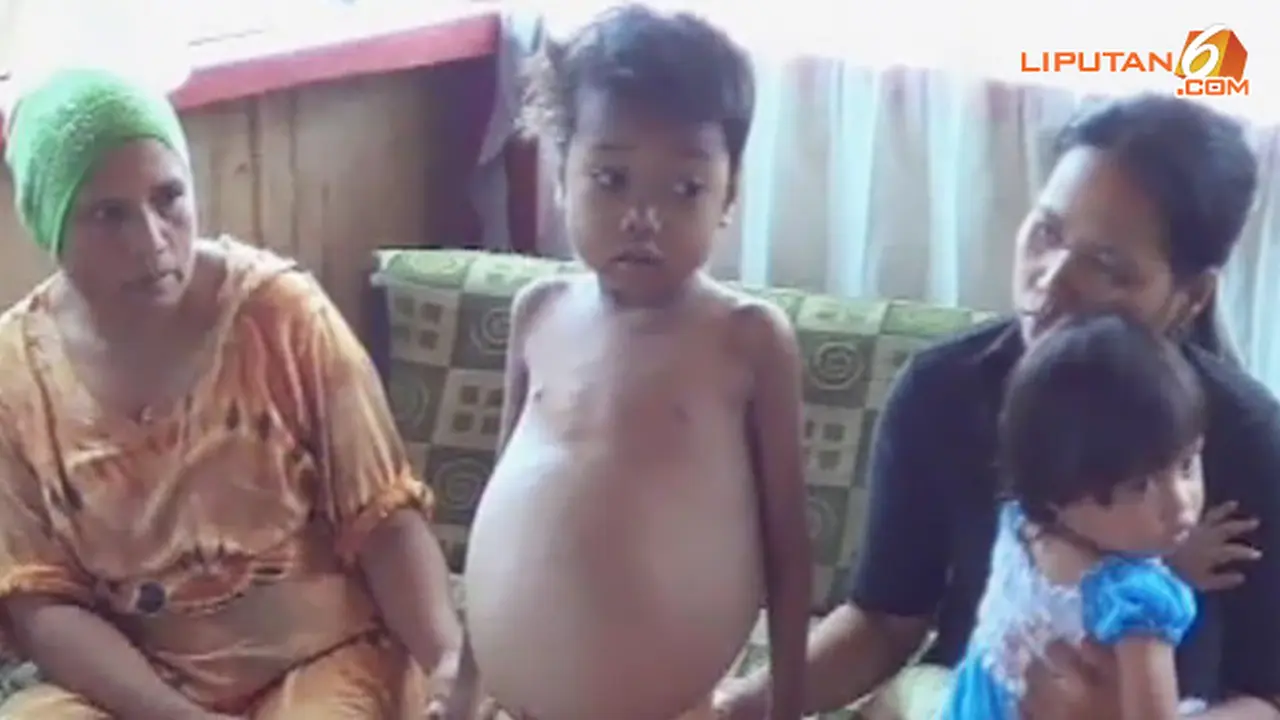 anak-talasemia-140110b.jpg