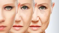 Tampak Lebih Muda dengan Face Lift, Tak Jamin Dongkrak Pede