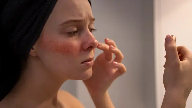 Perhatikan 5 Tanda Kerusakan Skin Barrier yang Sering Diabaikan - 2