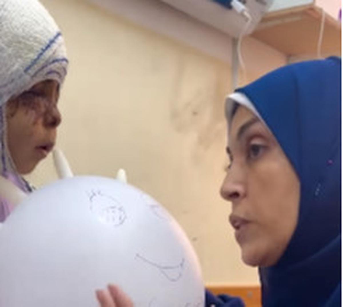 Pilunya Gadis Cilik Gaza Punya Luka Berat di Wajah Usai Serangan Israel