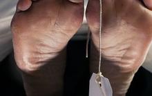 Pemotor di Bandung Tewas Terlilit Kabel Menjuntai di Jalan