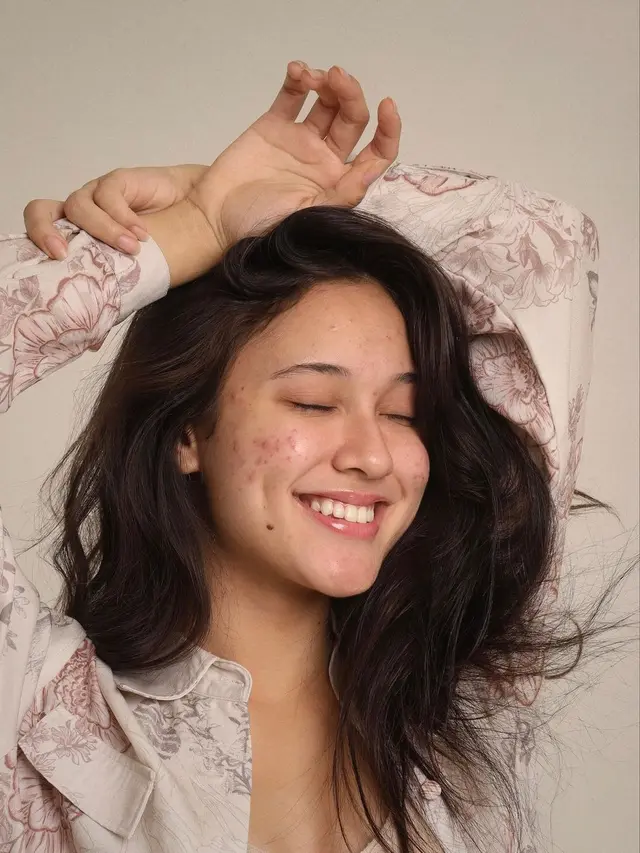 Pamer Wajah Berjerawat, Ini 7 Potret Yasmin Napper dengan Makeup Natural