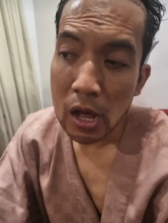 <p>&ldquo;Nggak ngerasain sakit, bagus banget ya tadi gua dibuat tidur selama 7 jam. Asik banget gua benar nggak berasa sama sekali&rdquo; ucap Desta. (Foto: Instagram/ dr_tompi)</p>