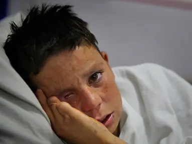 Farshid (13) menangis ketika berbaring di ranjang Pusat Bedah Darurat untuk Korban Perang Sipil di Kabul, Afghanistan, Kamis (12/12/201). Perang Afghanistan yang berlangsung selama empat dekade menimbulkan kerugian luar biasa di kalangan kaum muda. (AP Photo/Altaf Qadri)