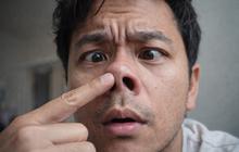 Mengapa Hidung Jarang Terlihat oleh Mata? Ini Penjelasan Ilmuwan