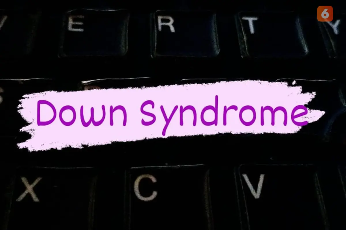 Down Syndrome
