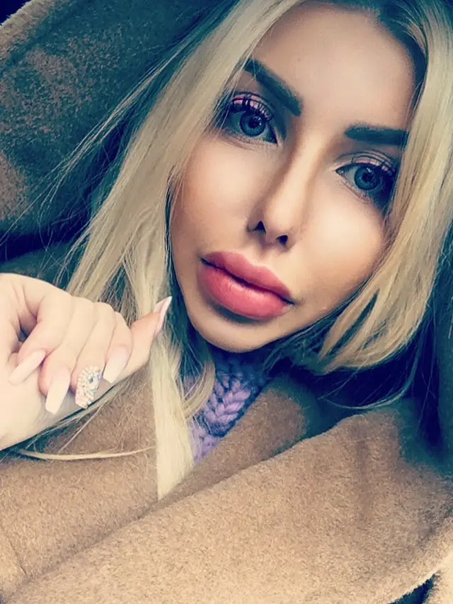 [Bintang] Operasi Plastik