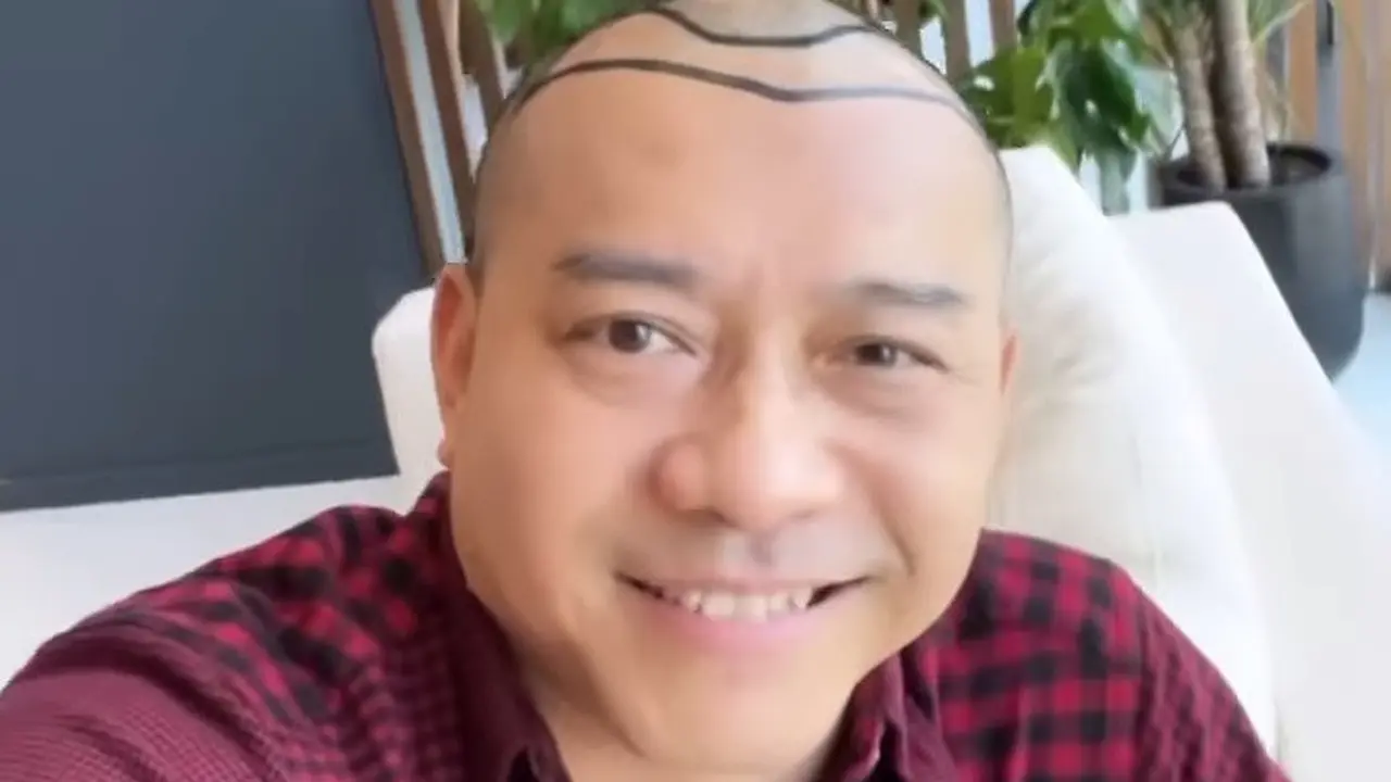 Anang Hermansyah