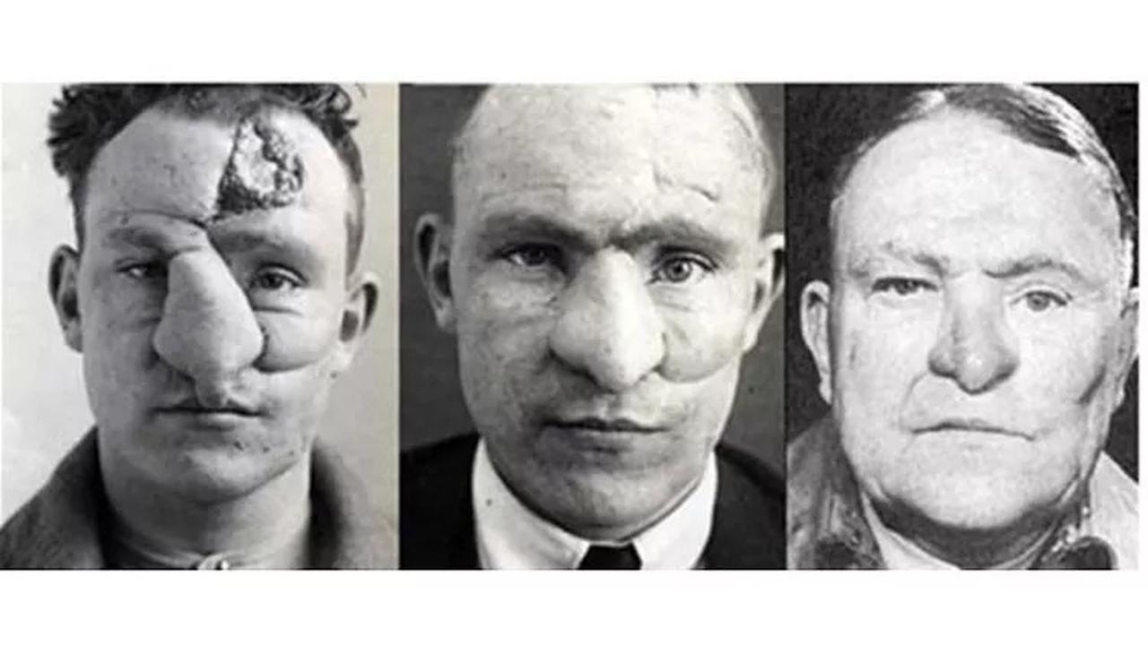 Foto Sebelum dan Sesudah Tentara Melakukan Operasi Plastik