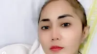 Aida Saskia Kembali Kehilangan Rambut Lebatnya saat Jalani Kemoterapi ke-8