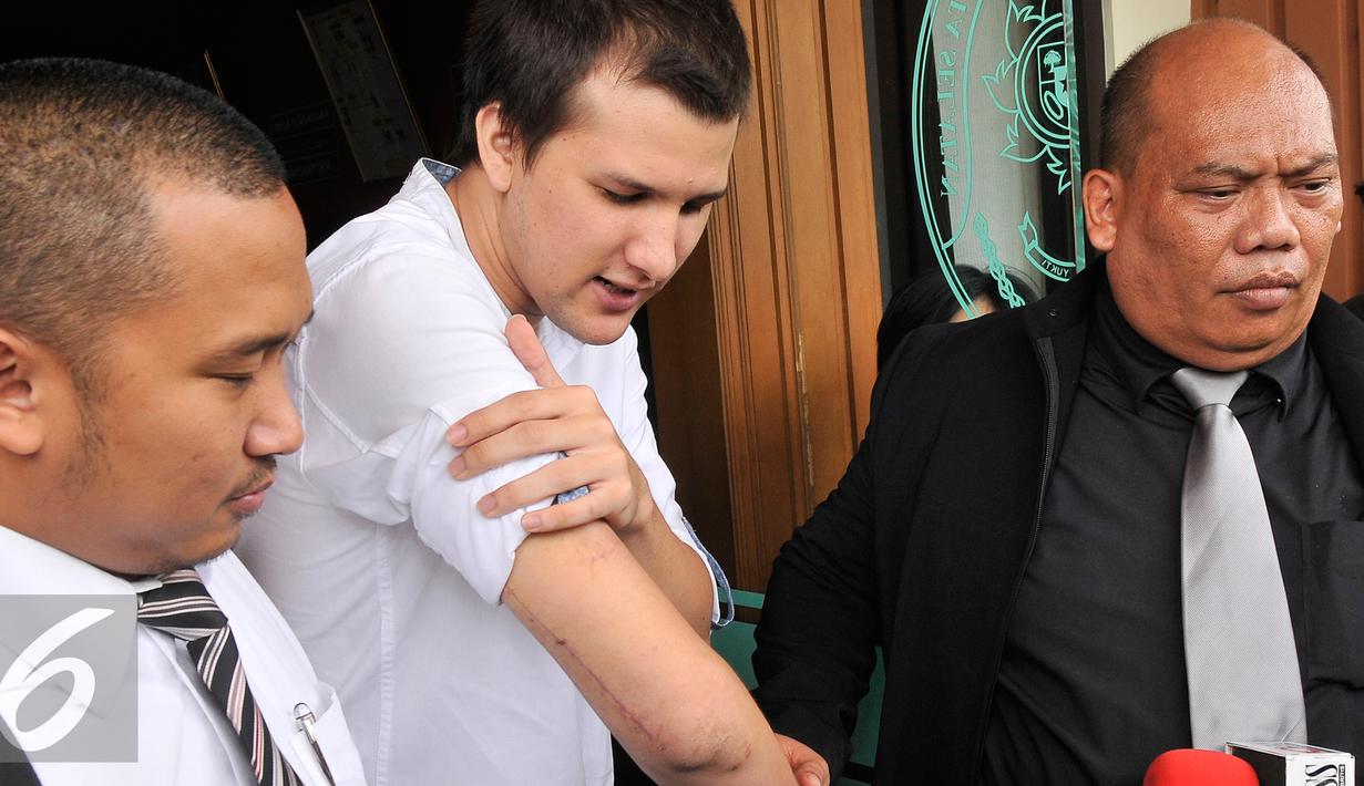 Stuart Collin menunjukan luka ditangannnya usai sidang perceraian yang digelar di Pengadilan Agama Jakarta Selatan, Senin (28/9/2015). sidang perdana Risty Tagor dan Stuart Collin akan dilanjutka sampai 12 oktober 2015. (Liputan6.com/Herman Zakharia)