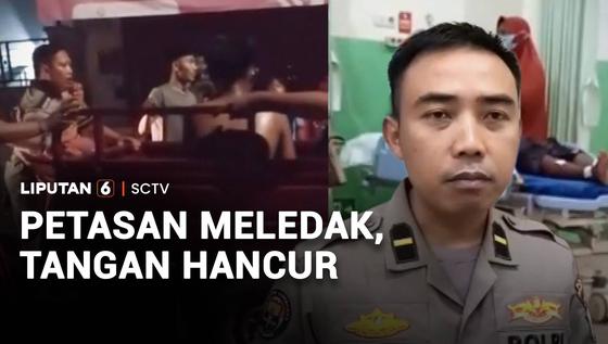 Petasan Meledak, Tangan Hancur