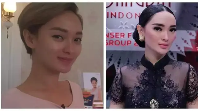 Potret Zaskia Gotik sebelum dan sesudah tanam benang (Sumber: KapanLagi.com & Instagram/@zaskia_gotix)