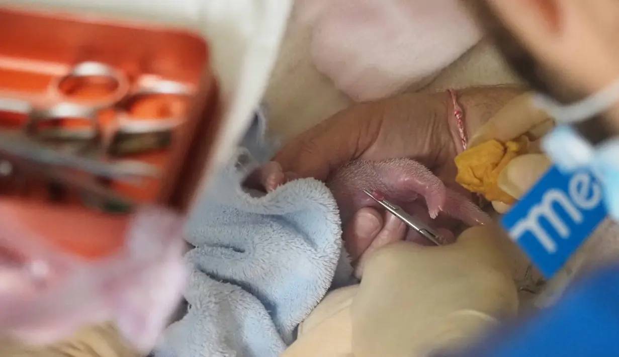 Seorang dokter hewan merawat anak kembar pertama yang dilahirkan panda betina Huan Huan di Beauval Zoo, Saint-Aignan-sur-Cher, Prancis, 1 Agustus 2021. Huan Huan melahirkan dua anak kembar dalam keadaan sehat. (Guillaume SOUVANT/AFP)