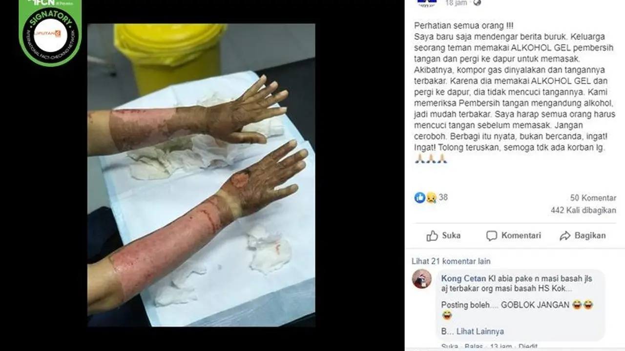 Gambar Tangkapan Layar Korban Luka Bakar
