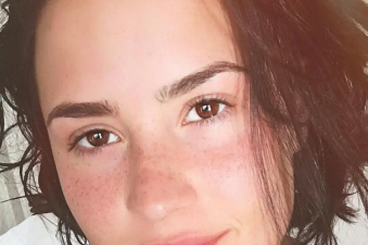 Sakit, Demi Lovato Dapat Dukungan dari Netizen