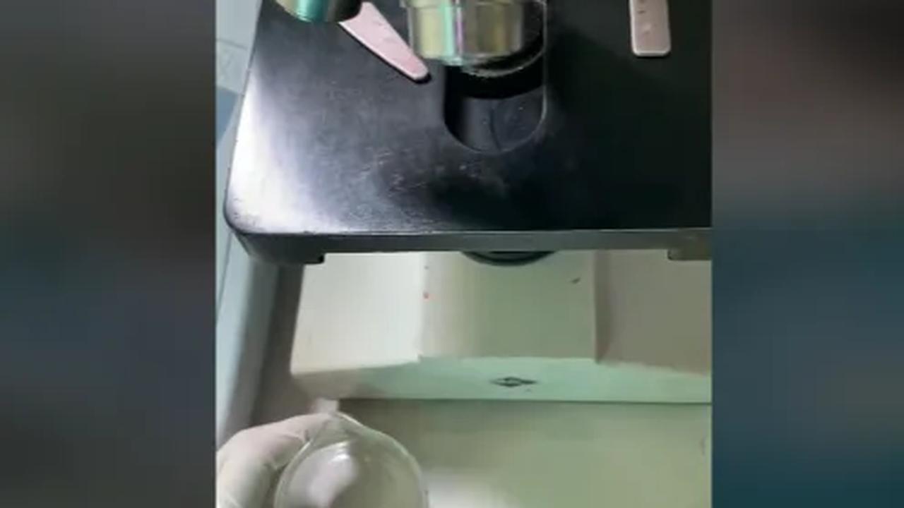 Dalam video dijelaskan Ia mengambil sample 1 tetes sel sperma.  <br>