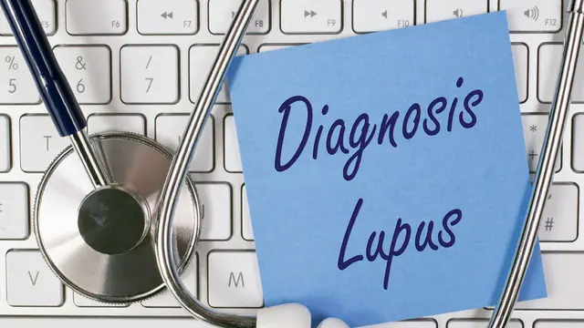 Obat Tradisional Penyakit Lupus