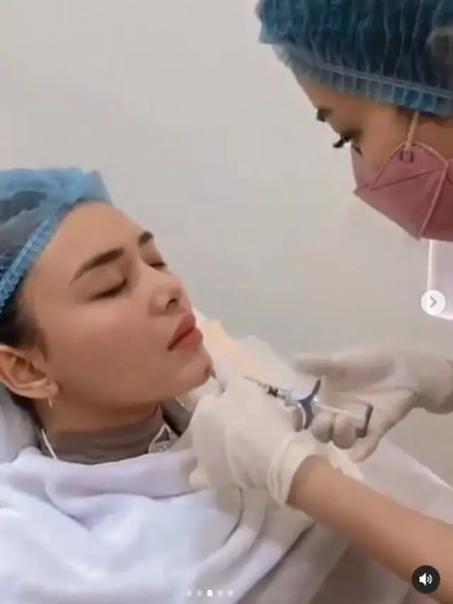 6 Potret Amanda Manopo Jalani Perawatan Wajah Suntik Dagu dan Pipi