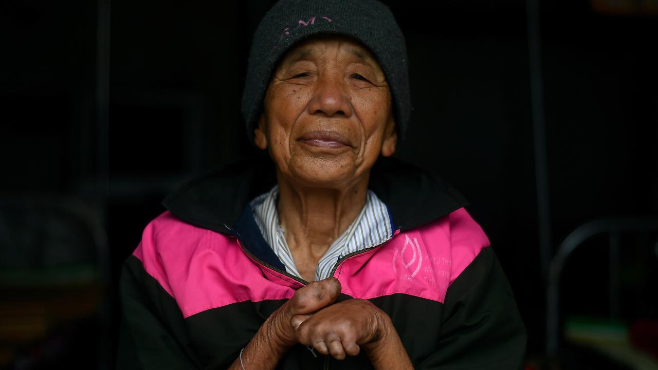 Kehidupan Para Penderita Kusta di Vietnam