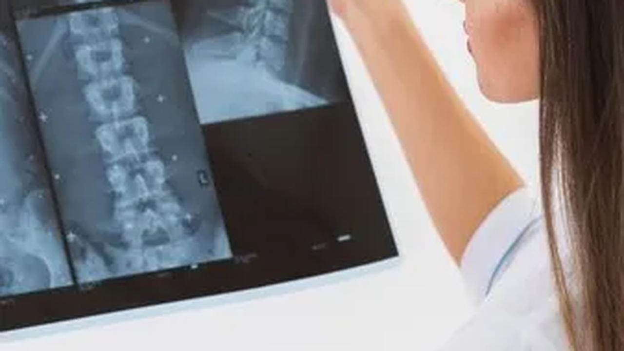 Tentang Osteoporosis
