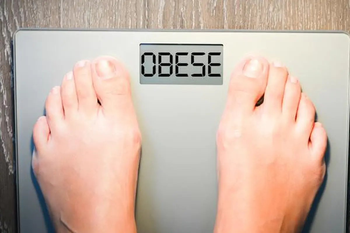 Ilustrasi Badan Gemuk atau Obesitas (iStockphoto)