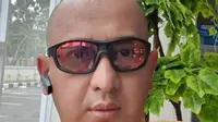 Kondisi Kesehatan Membaik, Ustaz Zacky Mirza Alami Pneumonia dan Pengentalan Darah