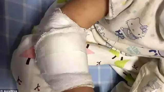 [Bintang] Gelang Karet