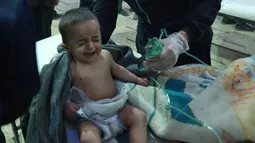 Seorang bayi menangis usai menghirup senjata kimia di Al-Shifuniyah, Ghouta Timur, Damaskus, Suriah, Minggu (25/2). Observatorium untuk HAM Suriah di Inggris mengatakan, 14 warga kesulitan bernapas usai serangan pemerintah. (HAMZA AL-AJWEH/AFP)