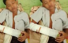 Konflik Lama Jadi Pemicu Perkelahian Siswa SMP hingga Patah Tangan di Lampung