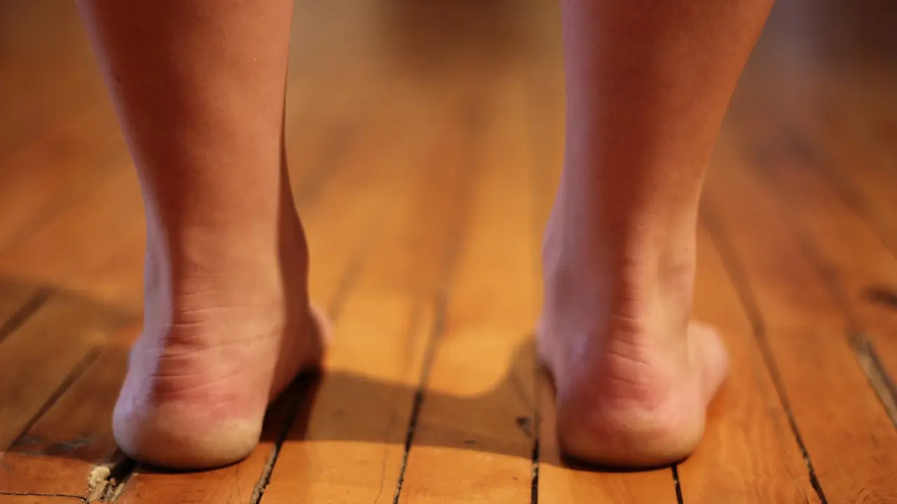 Adakah Olahraga yang Cocok Untuk si Kaki Datar?