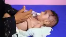 Seorang anak Yaman yang menderita malnutrisi menerima perawatan di sebuah rumah sakit di kota Hodeidah, Yaman (8/4). Pada akhir tahun 2017 lebih dari satu juta anak-anak menderita kekurangan gizi di tengah wabah kolera di Yaman. (AFP Photo/Abdo Hyder)