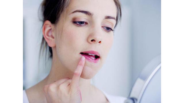 6 Penyebab Bibir Kering Fashion Beauty Liputan6 Com