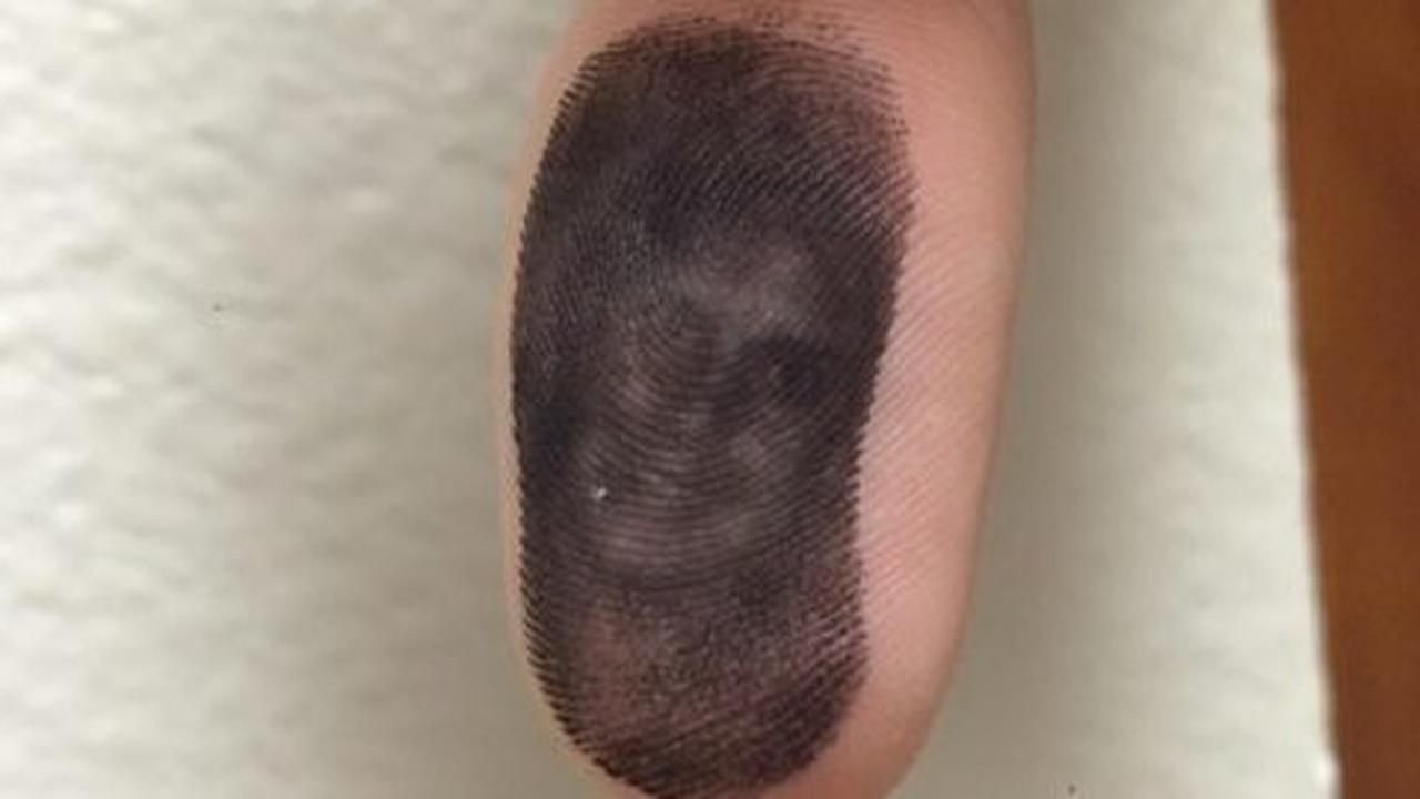 Seram, ada penampakan di jari tangan pria ini!