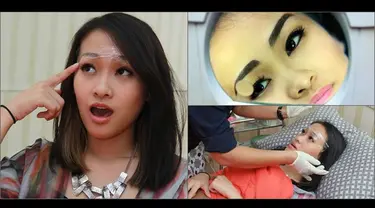 Karena susah membuat alis saat make up, Felly Eks Cherrybelle lakukan sulam alis agar terlihat lebih cantik.