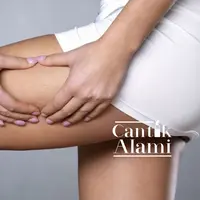 Ilustrasi adanya selulit di permukaan kulit. (boldsky.com)