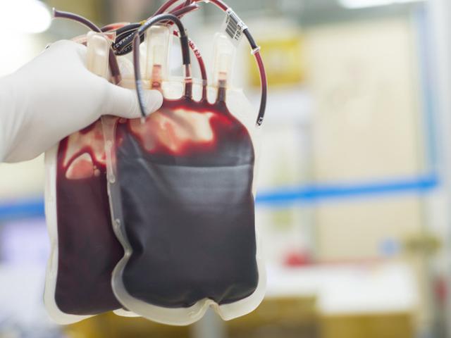 Kenali Penyakit Thalasemia Gejala Dan Pengobatannya Selain