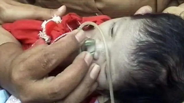 Mengungsi Dua Hari di Perkebunan, Bayi Alami Kritis