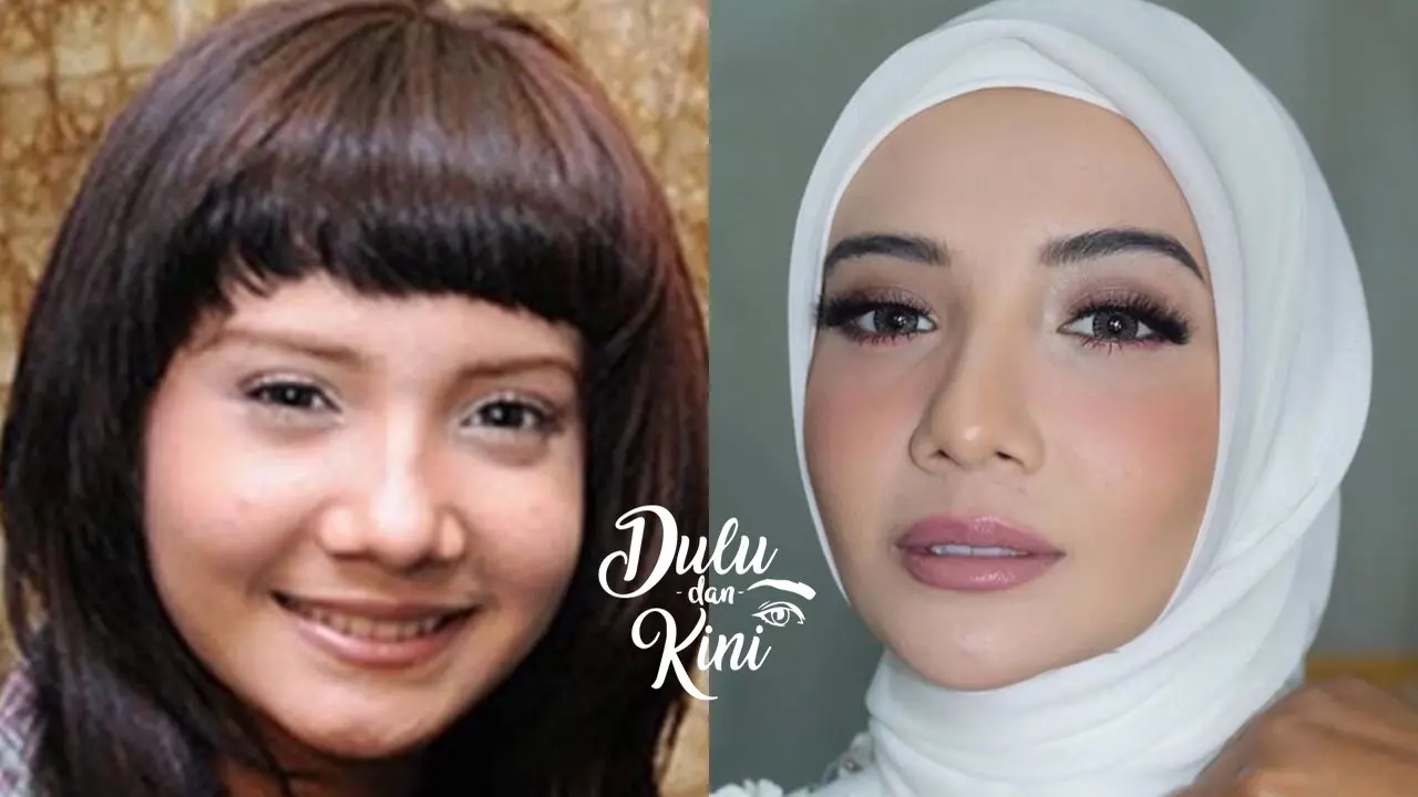 Dulu dan Kini: Bikin Pangling, Ini Transformasi Zaskia Sungkar