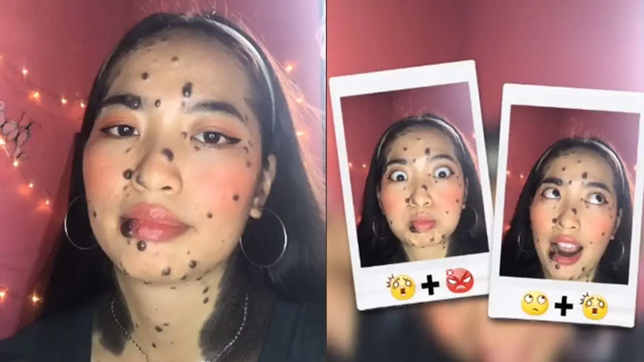 Viral Wanita Ini Punya Banyak Tahi Lalat di Wajah, Dipuji Tetap Cantik