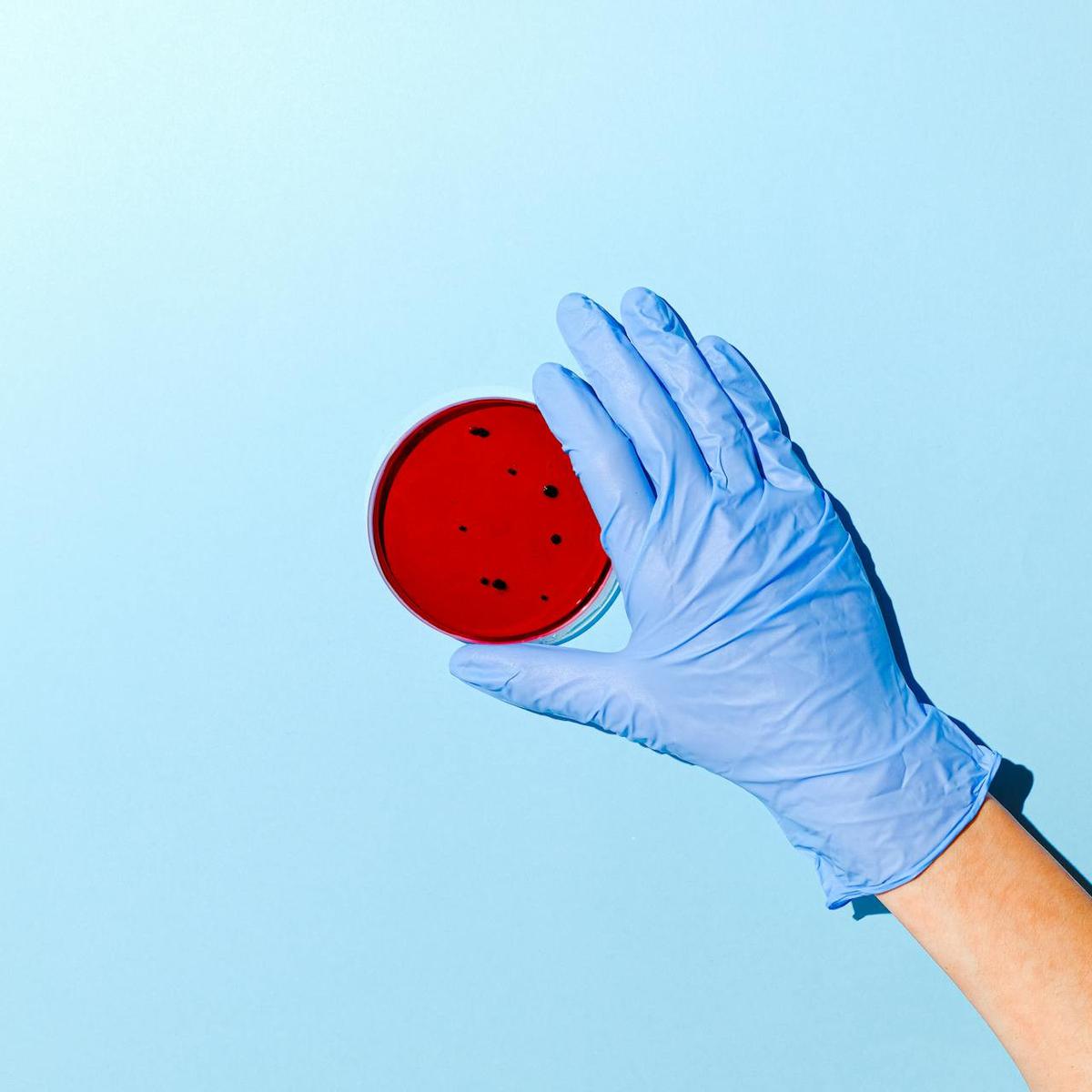 ilustrasi bacterial vaginosis