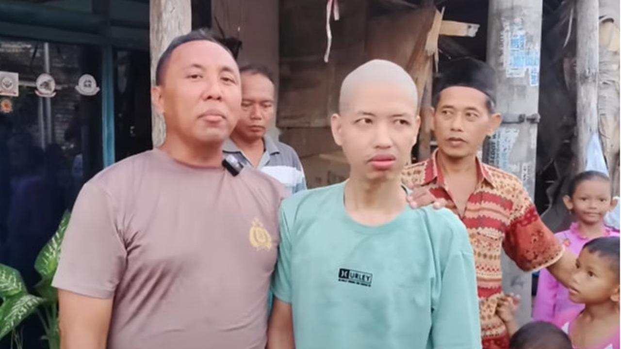 Dirayu akan Dibelikan Motor ODGJ Ganteng Ini Mau Dipotong Rambutnya, Ipda Purnomo 'Saya Rawat Sehat